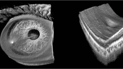 Handheld, rapidly switchable, anterior and posterior segment swept source optical tomography